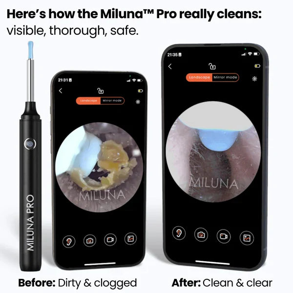 EAR WAX CLEANER